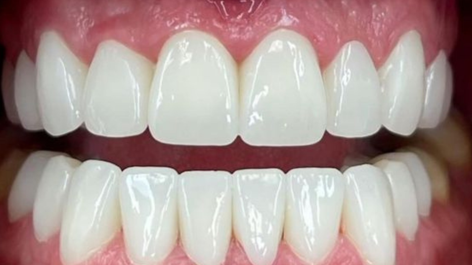 WhatsApp-Image-2025-06-11-at-10.10.27.jpeg WhatsApp-Image-2025-06-11-at-10.10.27.jpeg