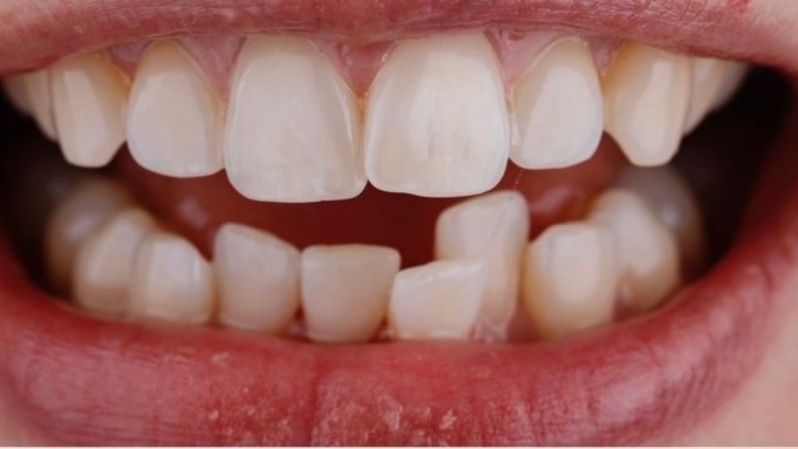 WhatsApp-Image-2025-06-11-at-10.10.37-1.jpeg WhatsApp-Image-2025-06-11-at-10.10.37-1.jpeg