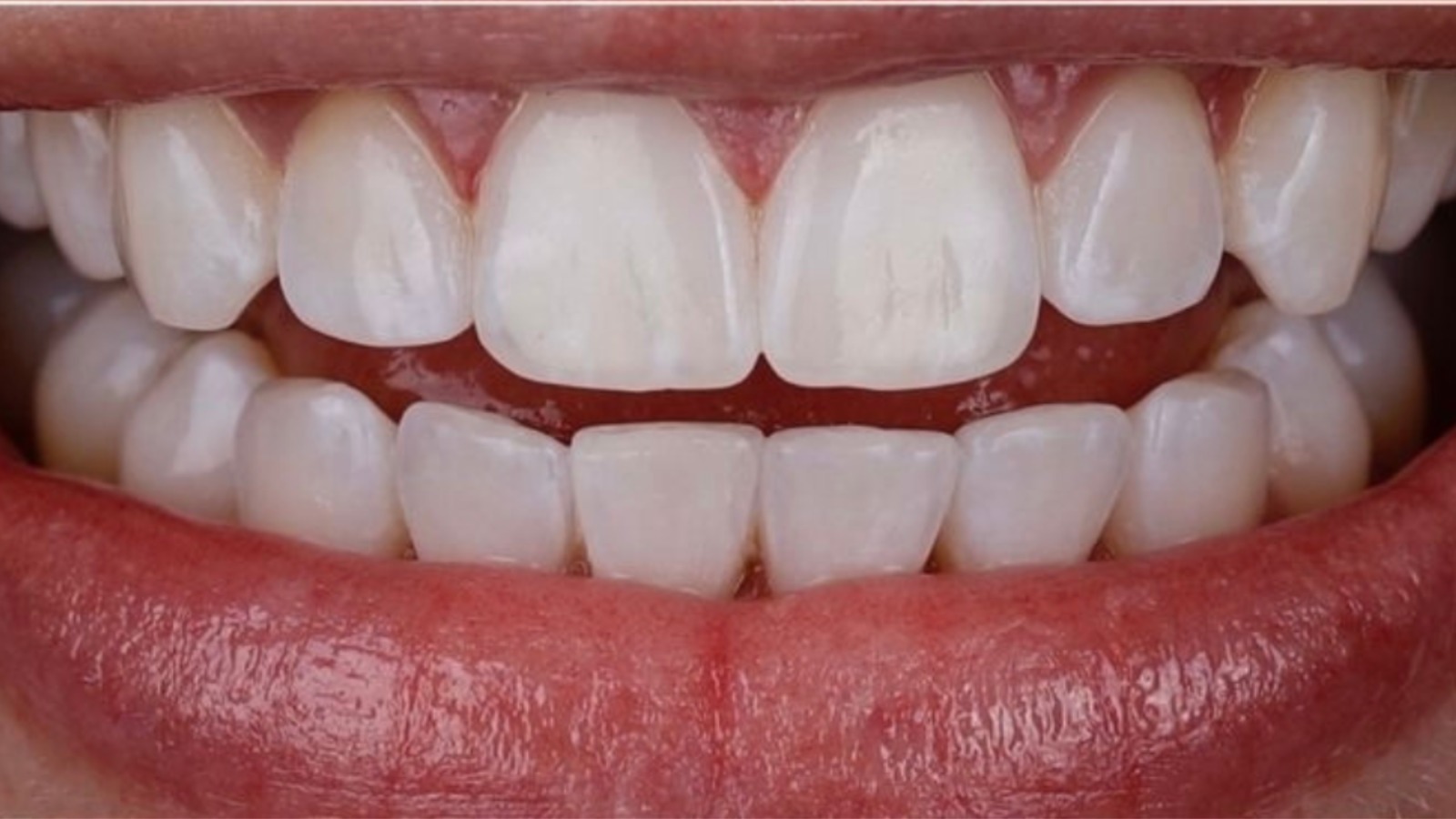 WhatsApp-Image-2025-06-11-at-10.10.37.jpeg WhatsApp-Image-2025-06-11-at-10.10.37.jpeg